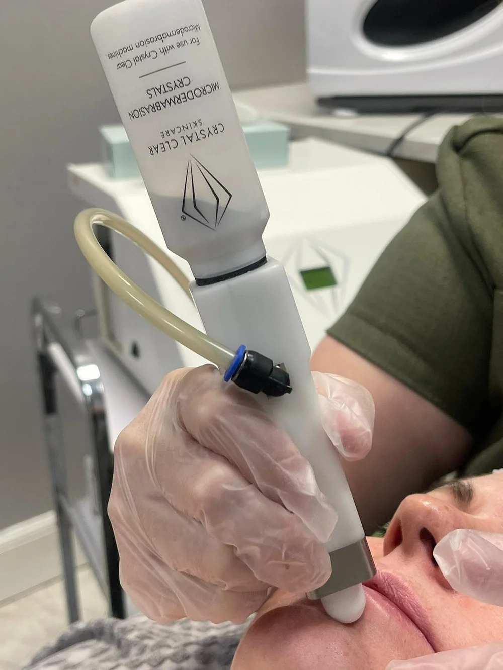 Microdermabrasion treatment at Sleeping Beauty