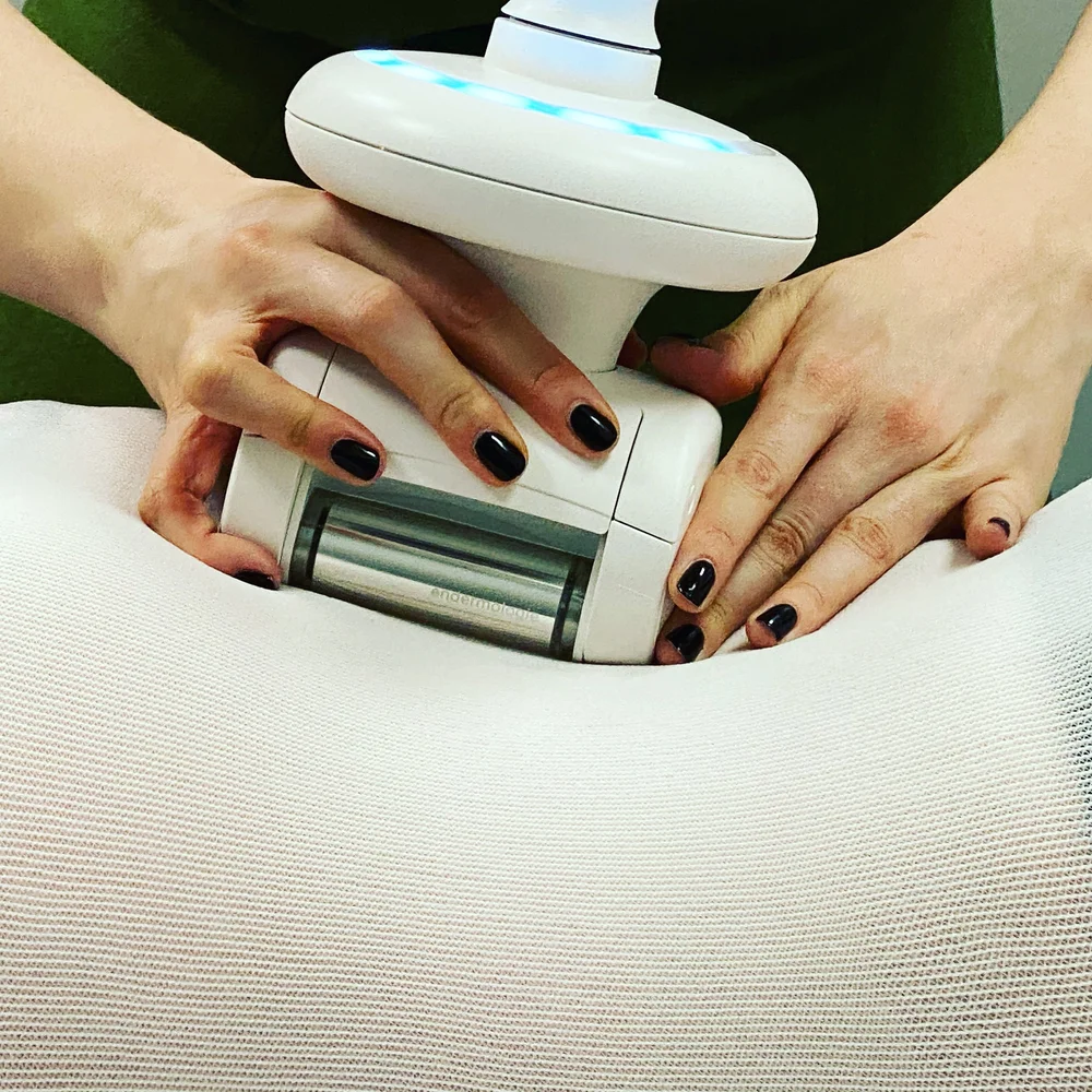 LPG Endermologie body treatment at Sleeping Beauty