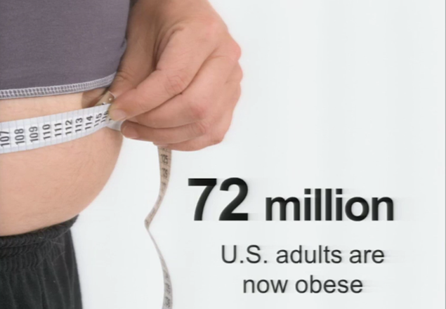 72 million obese.png