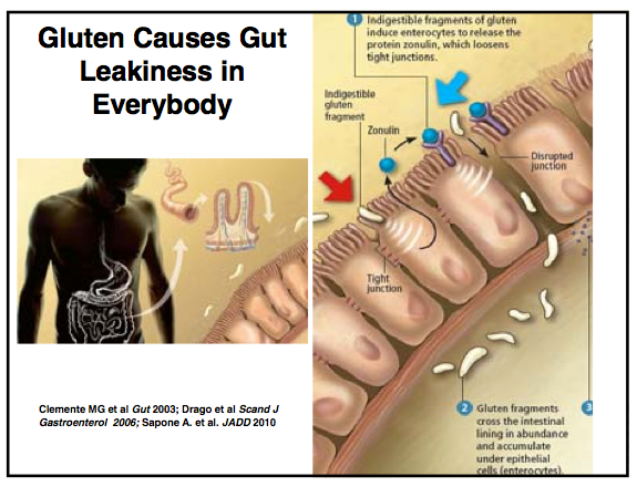 Glutenleakygut.jpg