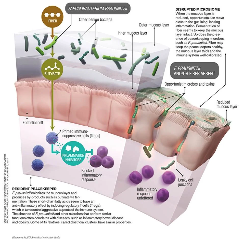 disruptedmicrobiome.jpg