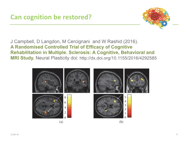 A recent study shows direct evidence of neuronal plasticity.