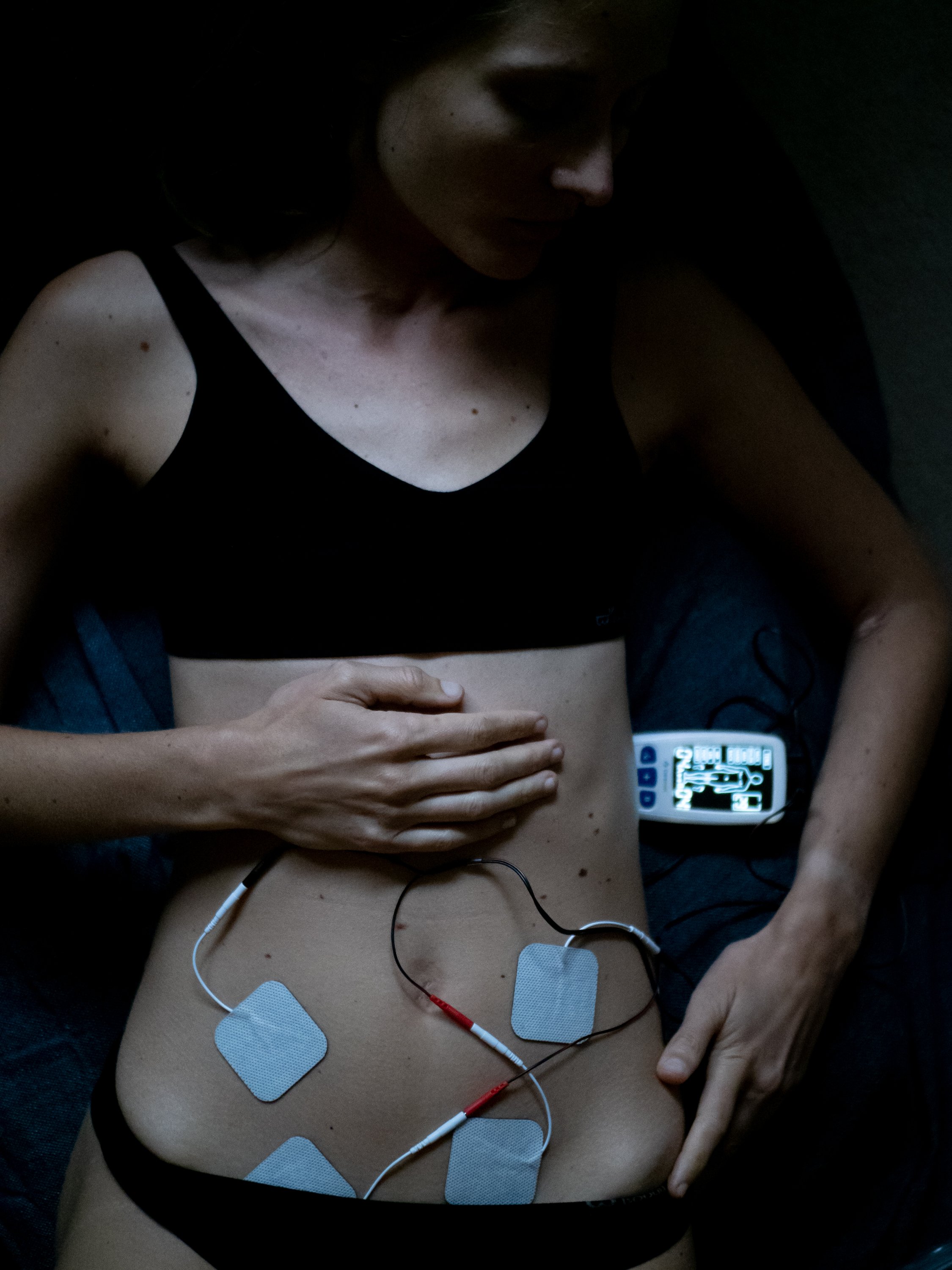  Transcutaneous electrical nerve stimulation (TENS) is a method of pain relief involving the use of a mild electrical current. The electrical impulses can reduce the pain signals going to the spinal cord and brain, which may help relieve pain and rel