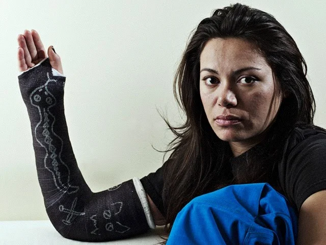 broken arm.jpg
