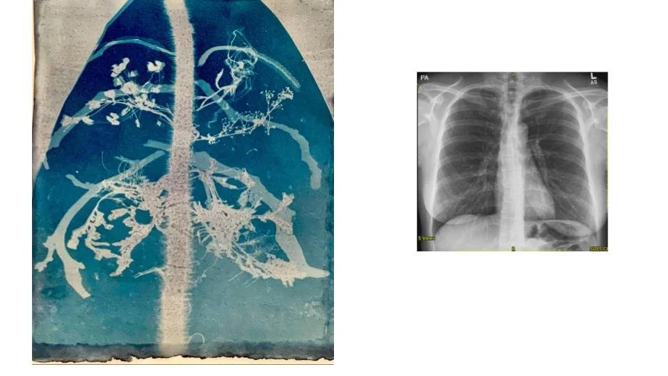cyanotypes & Mris copy.jpg