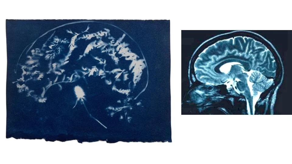 cyanotypes & Mris.jpg