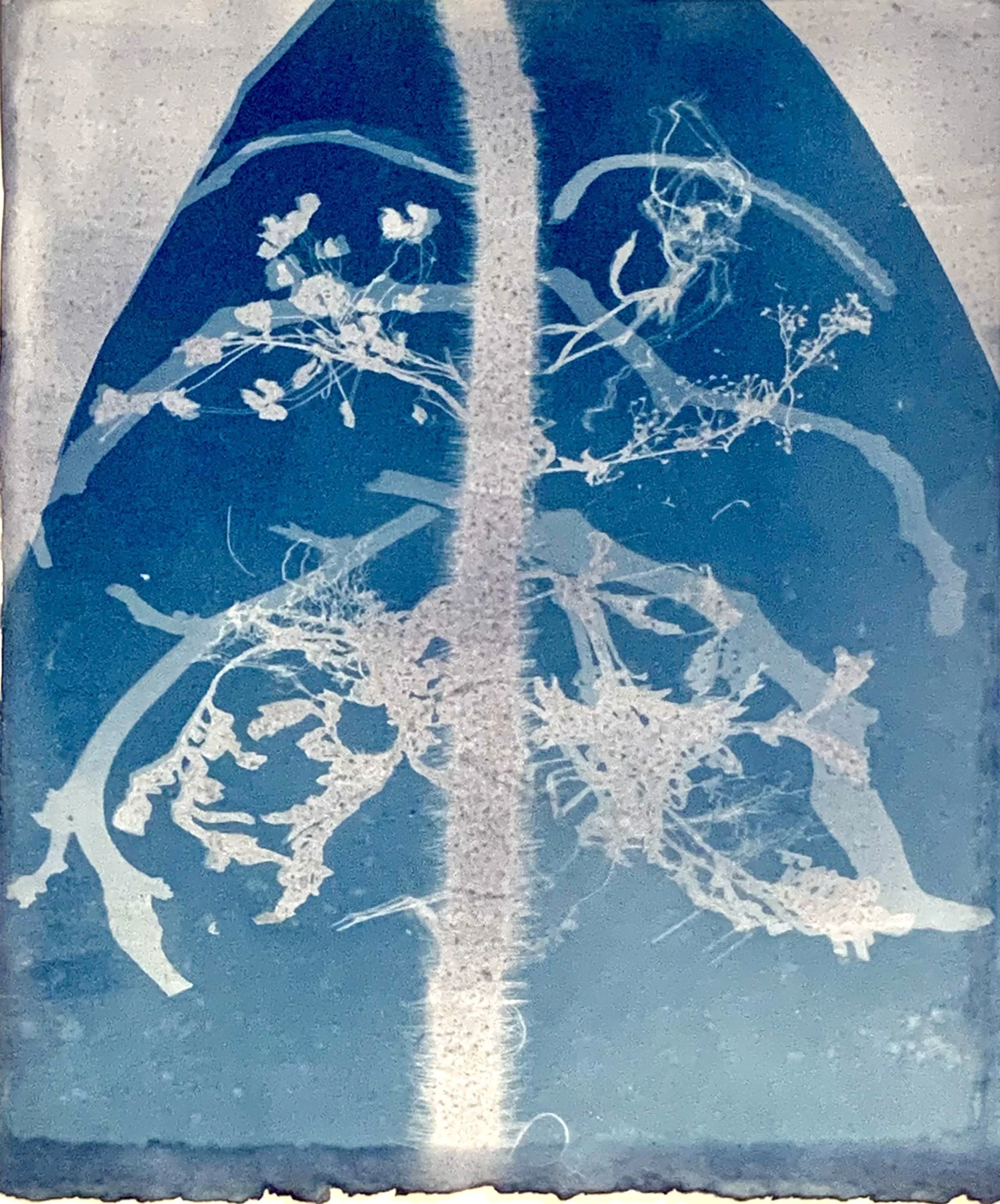 6. Rib Cage with Lungs.jpeg