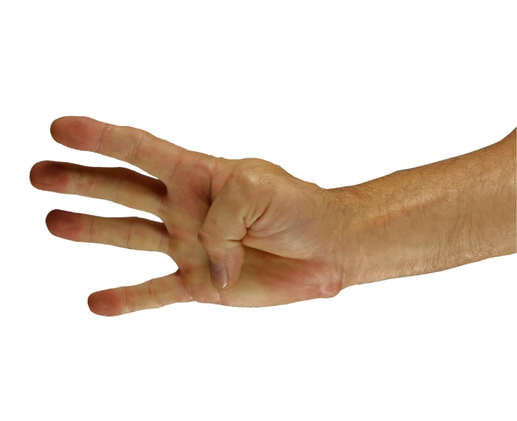 step one hand target hand.jpg