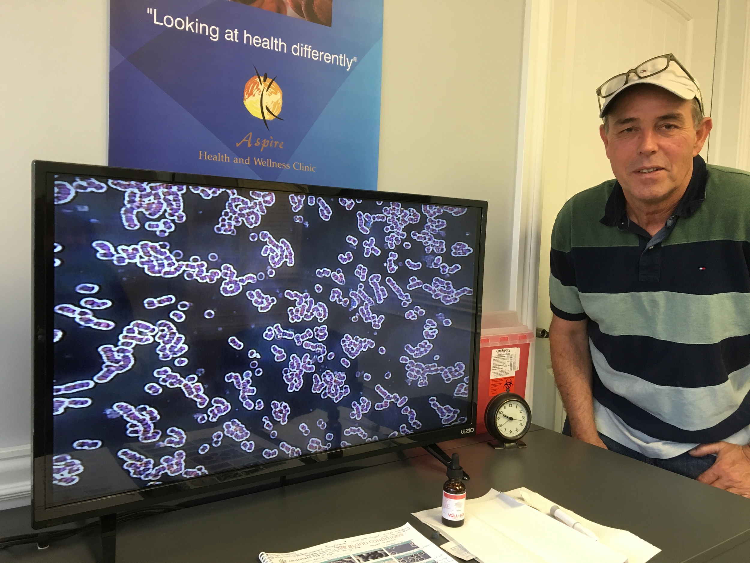 Tom had this "caterpillar" appearance to his blood because of his red blood cells sticking together.