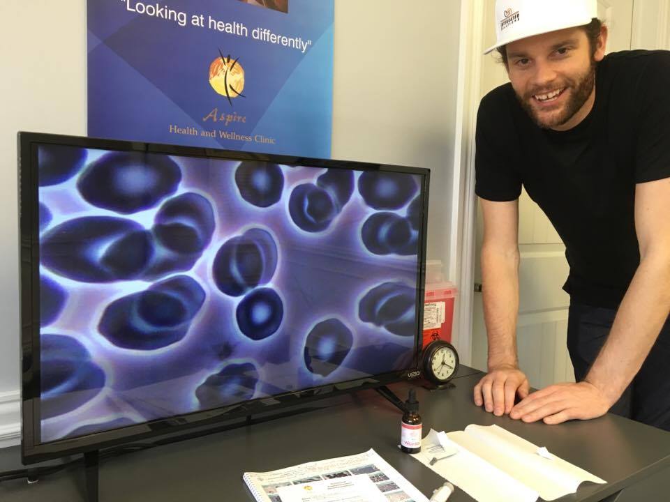 Among the Aggregation many of his red blood cells were also deformed and misshapen. This can be a result of poor nutrition or even free radical damage. There are also visible sugars in the blood plasma. 