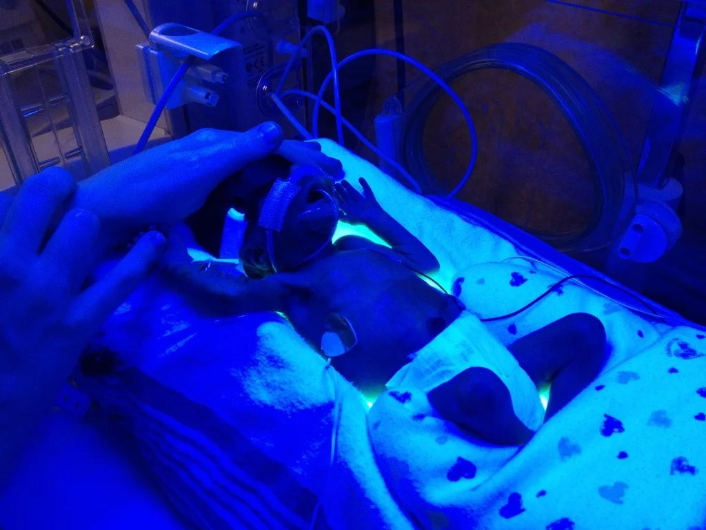 Hattie showing off her new PICC line.