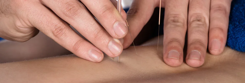 acupuncturepearl.jpg
