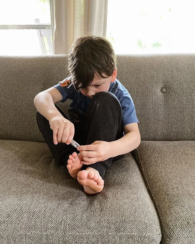 Dude, why you gotta trim your toenails on my couch yo?
