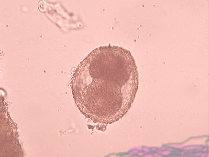 Embryonating egg