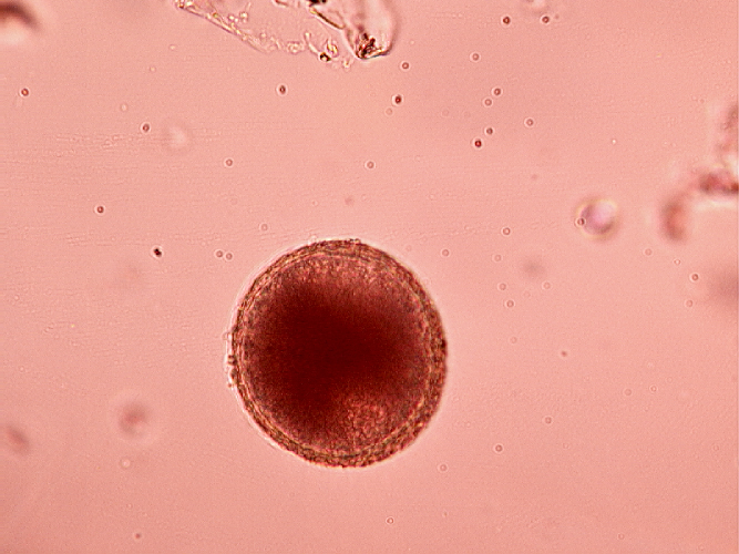 Unembryonated egg