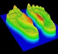 Effect of foot orthoses on the kinematics and kinetics of normal walking gait