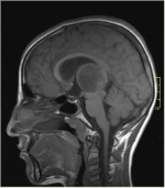 MRI扫描显示了人类大脑的结构。