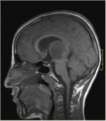 MRI scan showing the structure of the human brain.