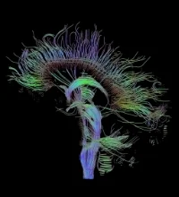 Diffusion tensor image showing white matter tracts of the human brain.