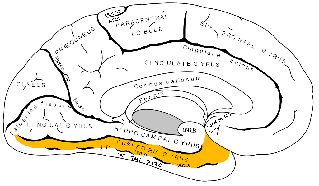 Fusiform gyrus (in orange).