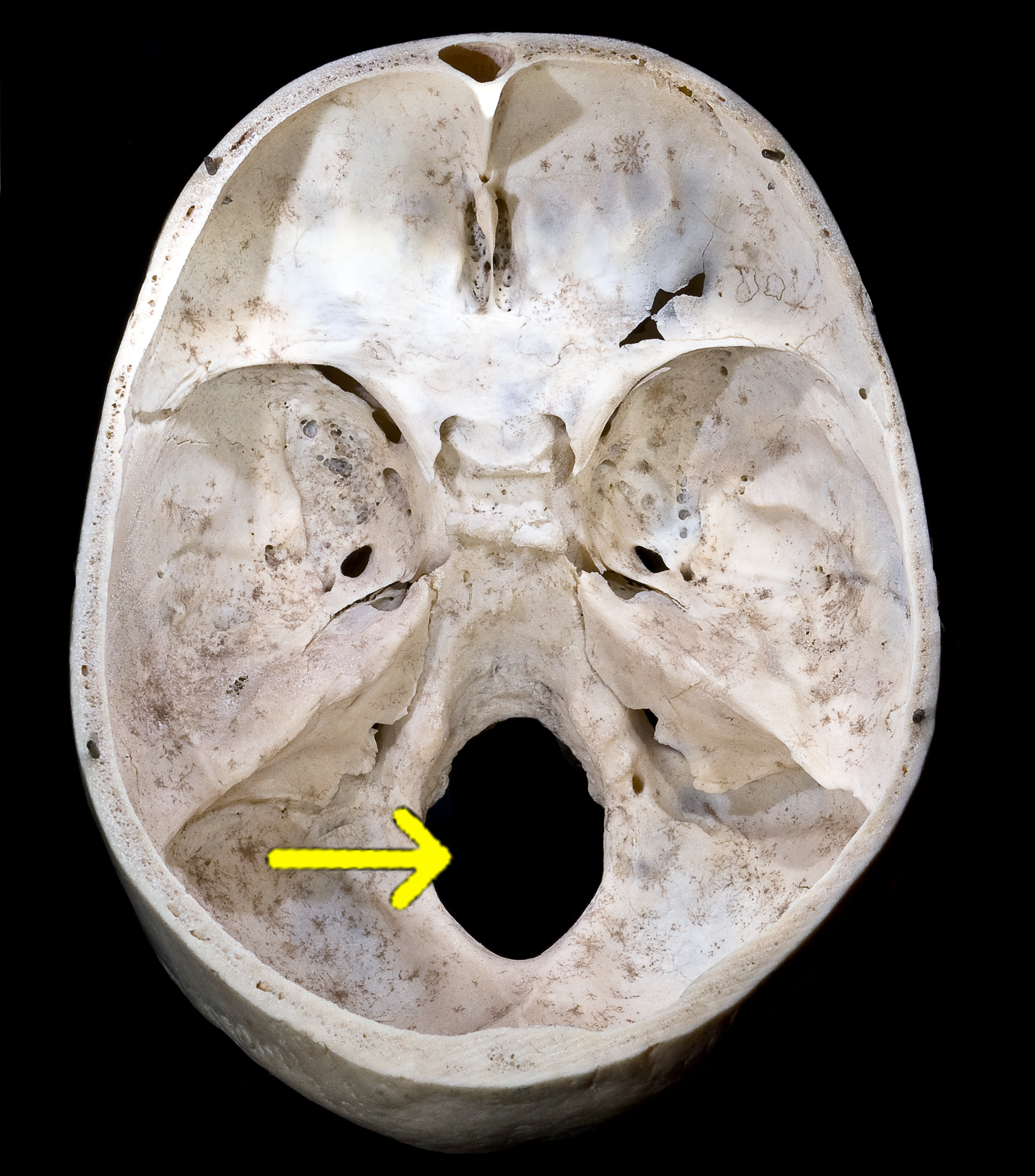 Foramen magnum. Image courtesy of Didier Descouens.