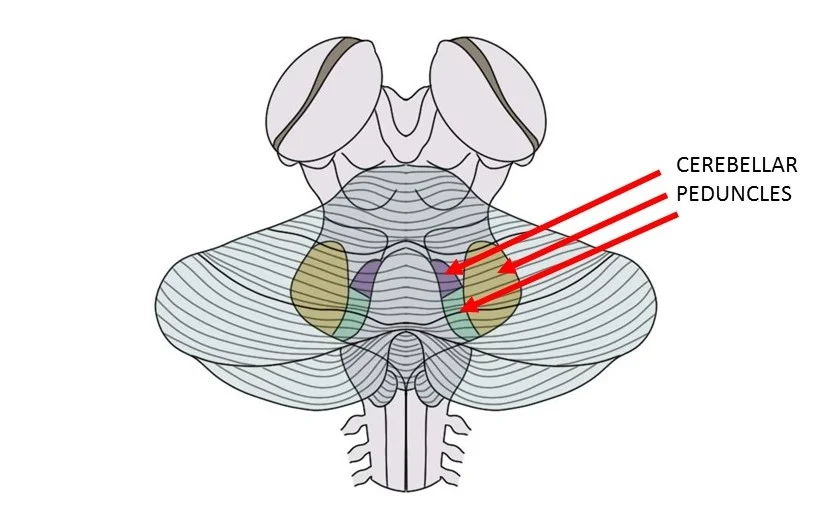 Cerebellar peduncles.