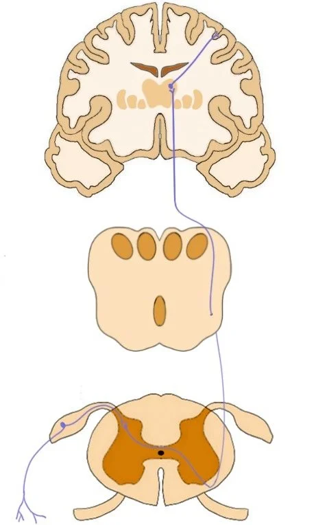 spinothalamic tract represented by the purple nerve fiber traveling up from the spinal cord, through the medulla, and to the thalamus. in the thalamus the fibers synapse with thalamic neurons that carry the signal to the somatosensory cortex..