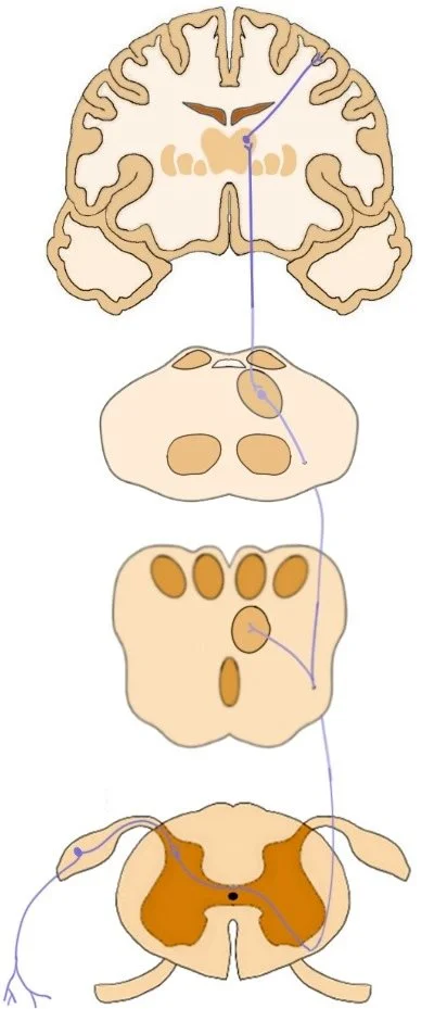 SPINoreticular TRACT REPRESENTED BY THE PURPLE NERVE FIBER TRAVELING UP FROM THE SPINAL CORd and synapsing in areas of the reticular formation in the brainstem.