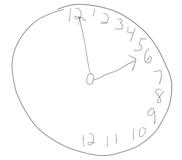 这是一个由半脑性疏忽病人画的时钟的例子。