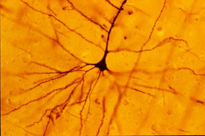 高尔基染色的锥体神经元