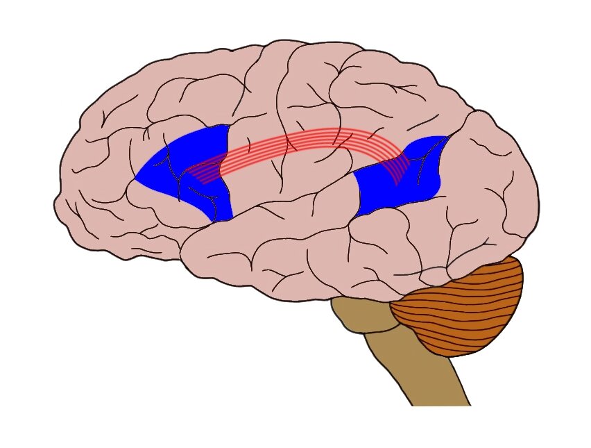 在此图像中，Broca区由蓝色区域更靠近大脑的前（左）表示，而韦尼克区是由蓝色区域接近大脑（右）后表示。红色线表示弓状束，连接两个区域。