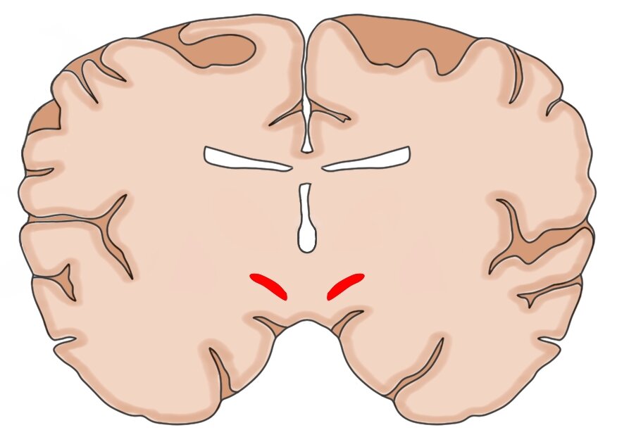 大脑的冠状部分，具有红色突出的亚粒细胞核。