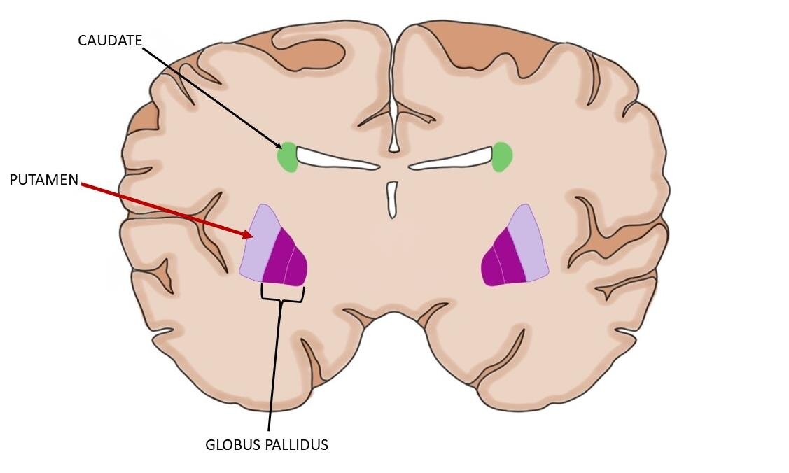 在这种冠状脑部分，该壳是彩色浅紫色的区域。苍白球和尾状也示在图像中。