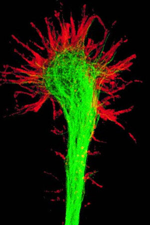 GROWTH CONE OF AN AXON.