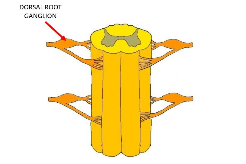 SPINAL CORD WITH ARROW INDICATING A DORSAL ROOT GANGLION.