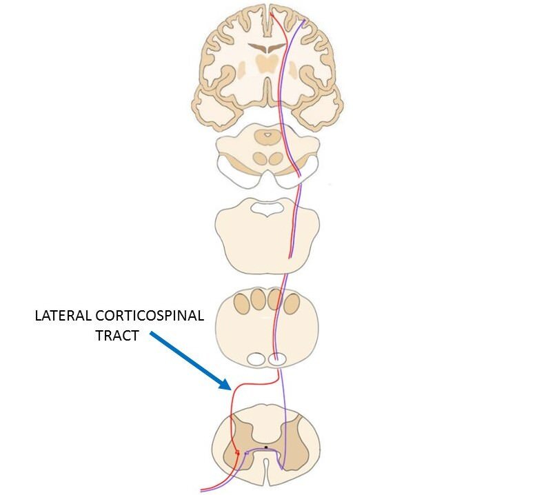 THE LATERAL CORTICOSPINAL TRACT IS REPRESENTED BY THE RED LINE THAT RUNS FROM THE MOTOR CORTEX DOWN TO THE SPINAL CORD.