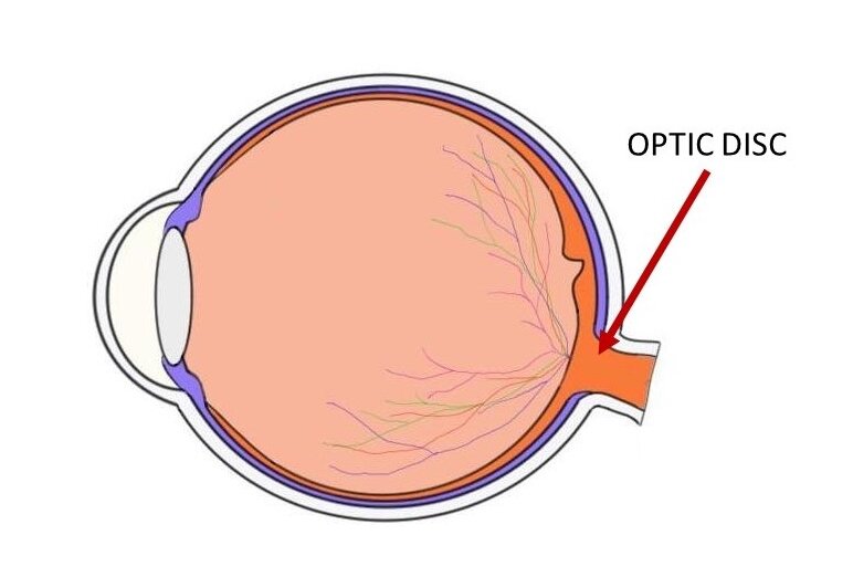 optic disc