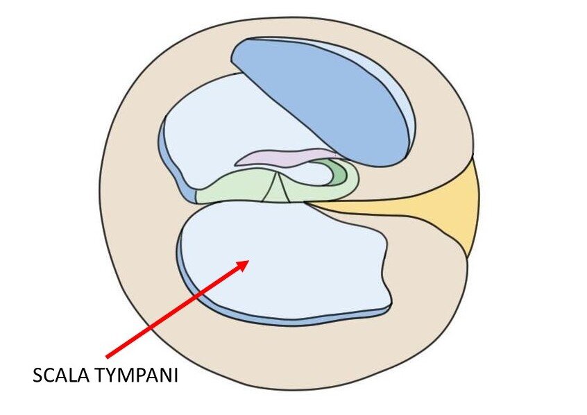 CROSS-SECTION OF THE COCHLEA WITH AN ARROW DESIGNATING THE SCALA TYMPANI.