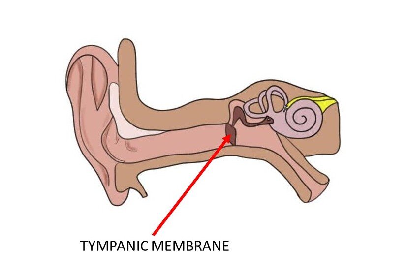 显示鼓起的鼓蛋膜的耳朵的图象。