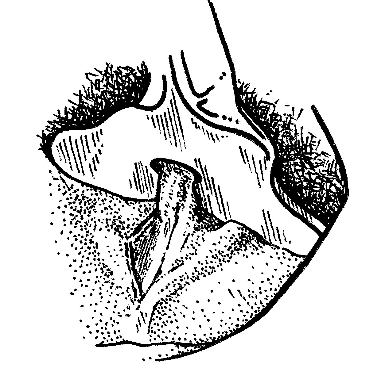 After central release is made, the mucous membrane release on one side is started