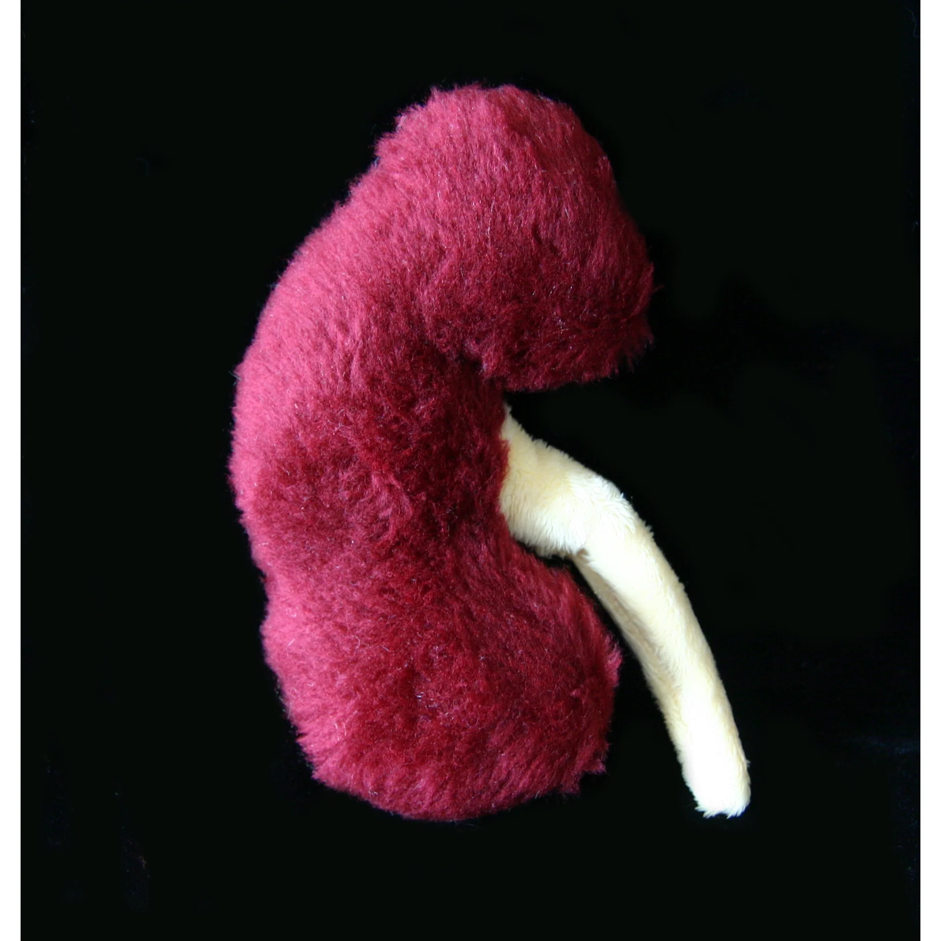 Kidney