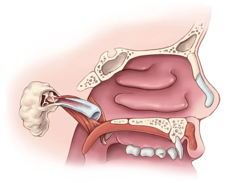Palate and Eustachian Tube: Profile