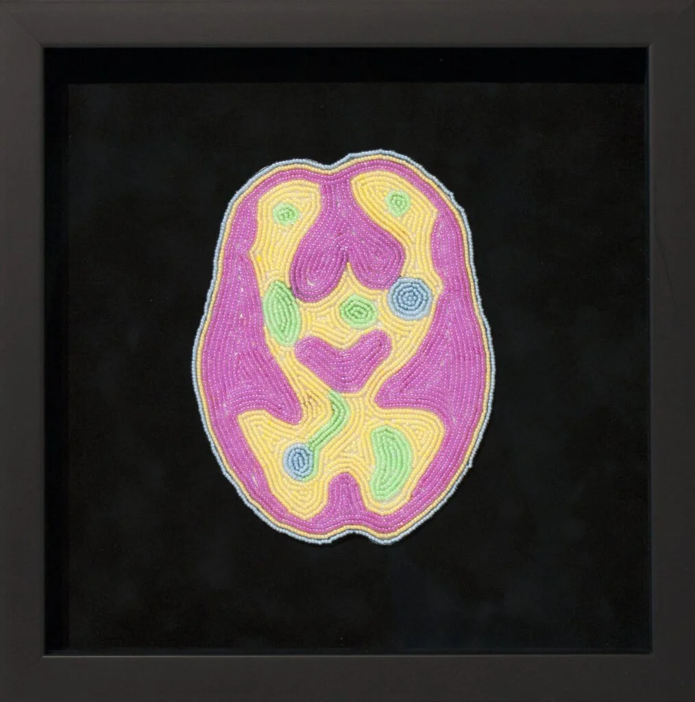   Ruth Cuthand  (Plains nêhiyew (Cree),  Little Pine First Nation / Saskatoon, SK)    Mania    glass beads, thread, backing  28.6 x 28.6 x 3.4 cm  2020  Indigenous Art Collection, Crown-Indigenous Relation and Northern Affairs Canada 