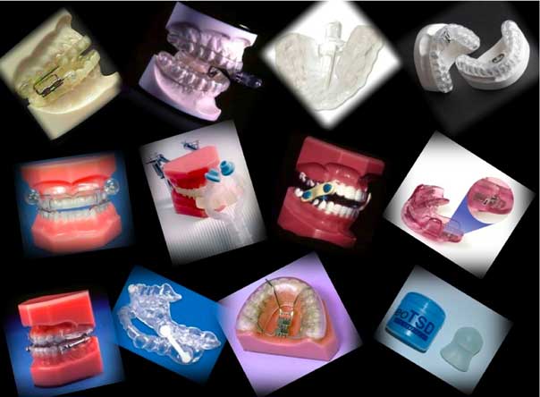 Do Oral Appliances to Manage Sleep Apnea Work?