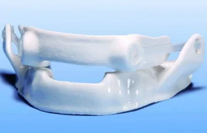 ResMed Webinar: Enhancing Retention of a Narval CC Sleep Apnea Appliance and much more...