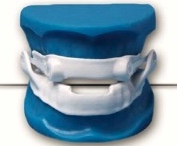 2009: First CadCam Narval - Silicone Covered