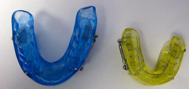 Left: Patient Herbst, Right: Sample Herbst