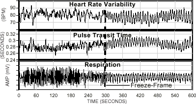 Fig 1 Taken from 'Science of The Heart' Heart Math Institute