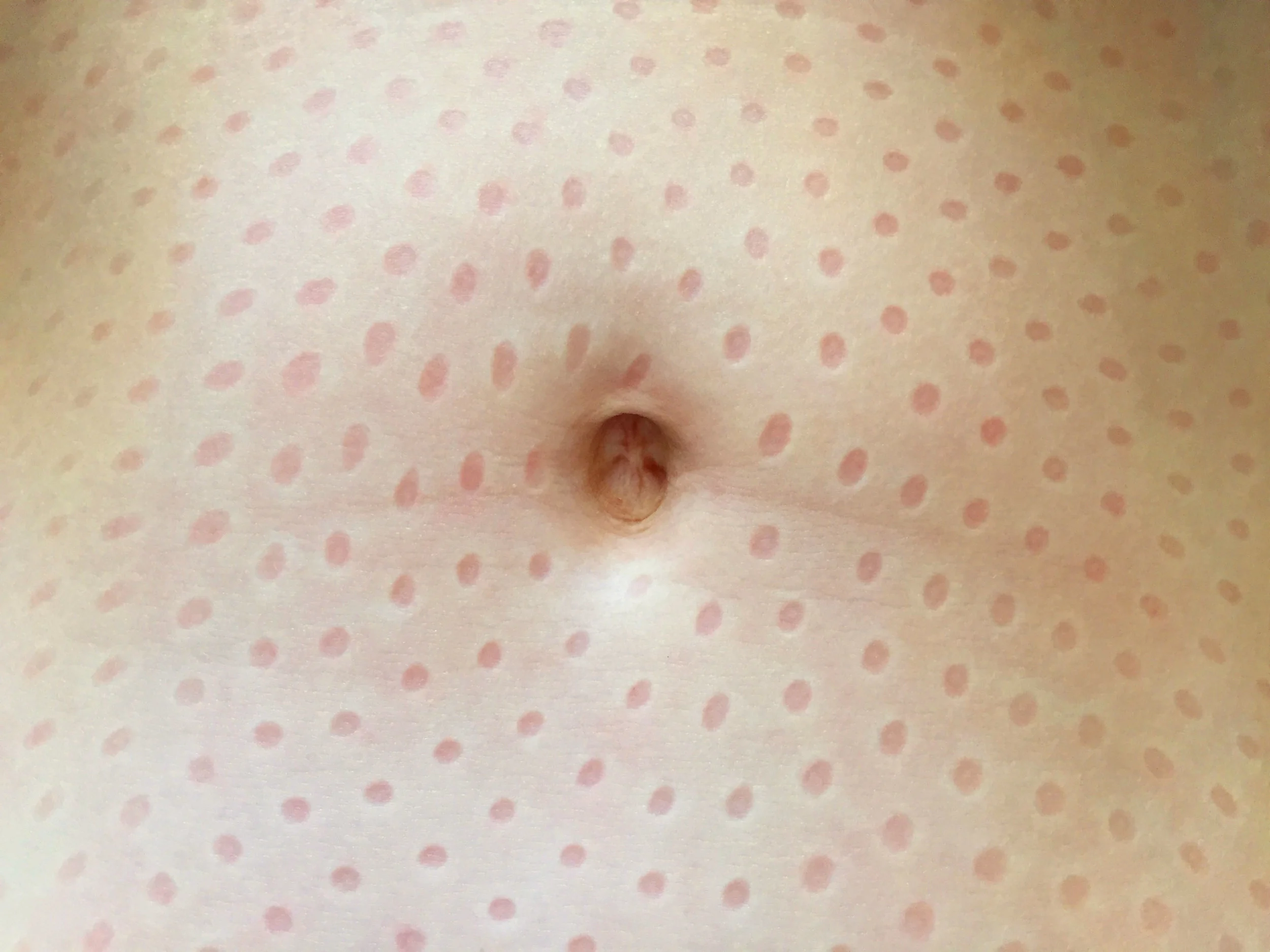 bauch.jpg