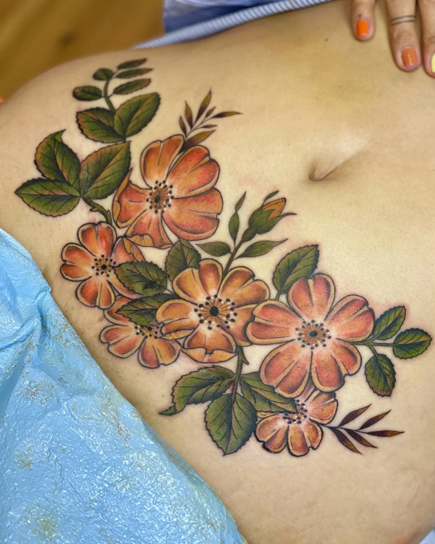 C-section scar coverup